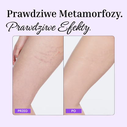 Perfektor do Ciała