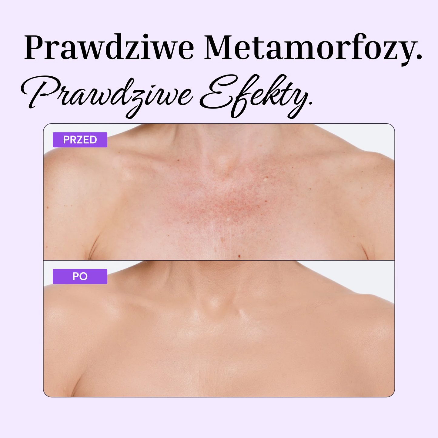 Perfektor do Ciała