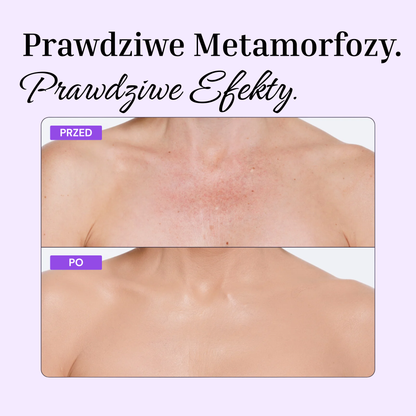 Perfektor do Ciała
